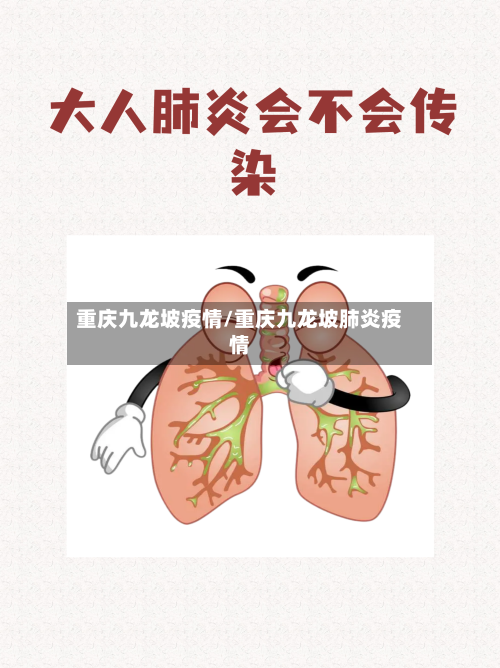 重庆九龙坡疫情/重庆九龙坡肺炎疫情